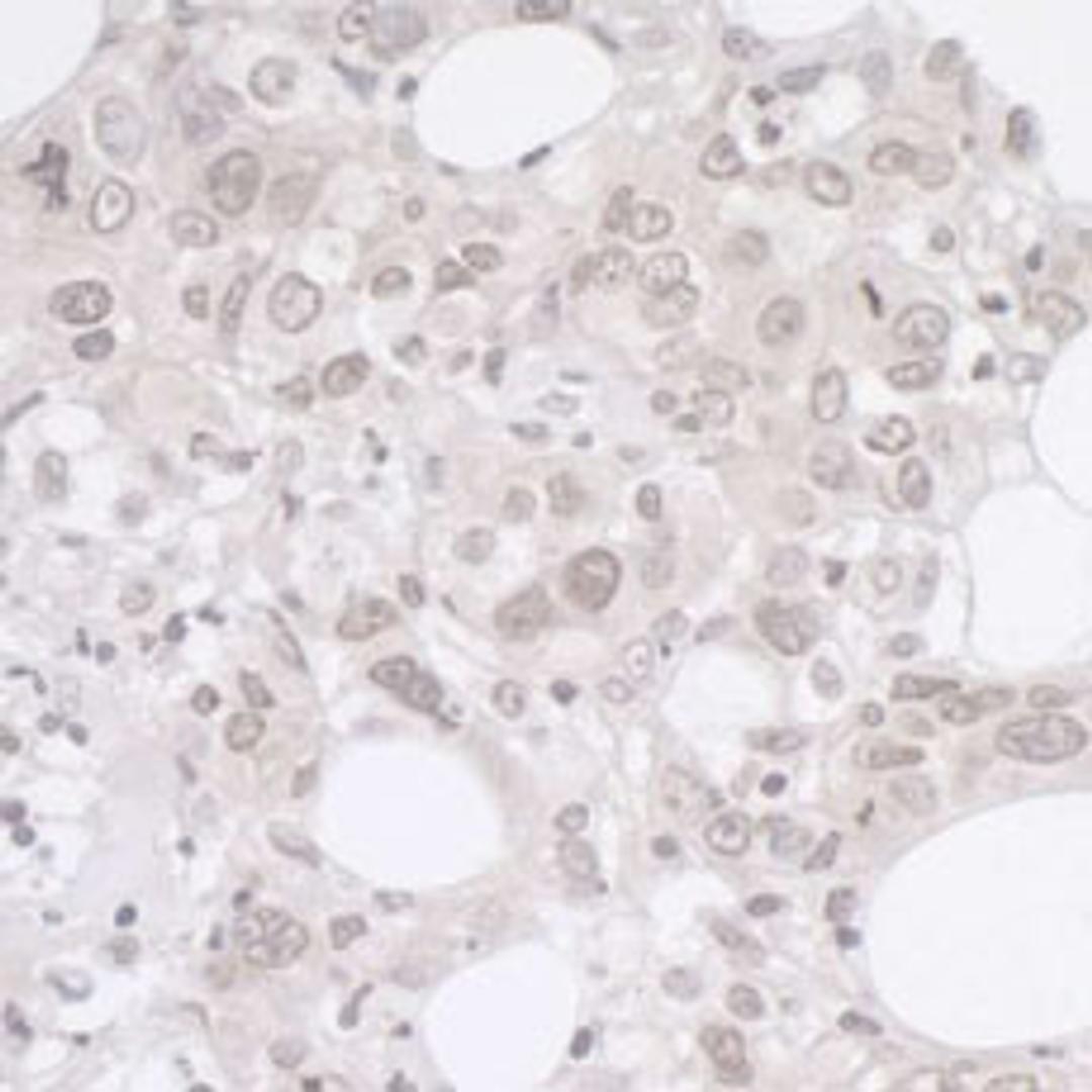 Detection of human ADRM1 by immunohistochemistry.