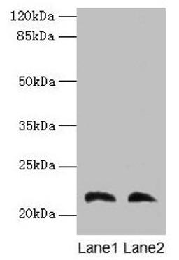 Western blot. All lanes: LGALS9C antibody at 4µg/ml. Lane 1: Mouse stomach tissue. Lane 2: Mouse liver tissue. Secondary. Goat polyclonal to rabbit IgG at 1/10000 dilution. Predicted band size: 40 kDa. Observed band size: 22 kDa