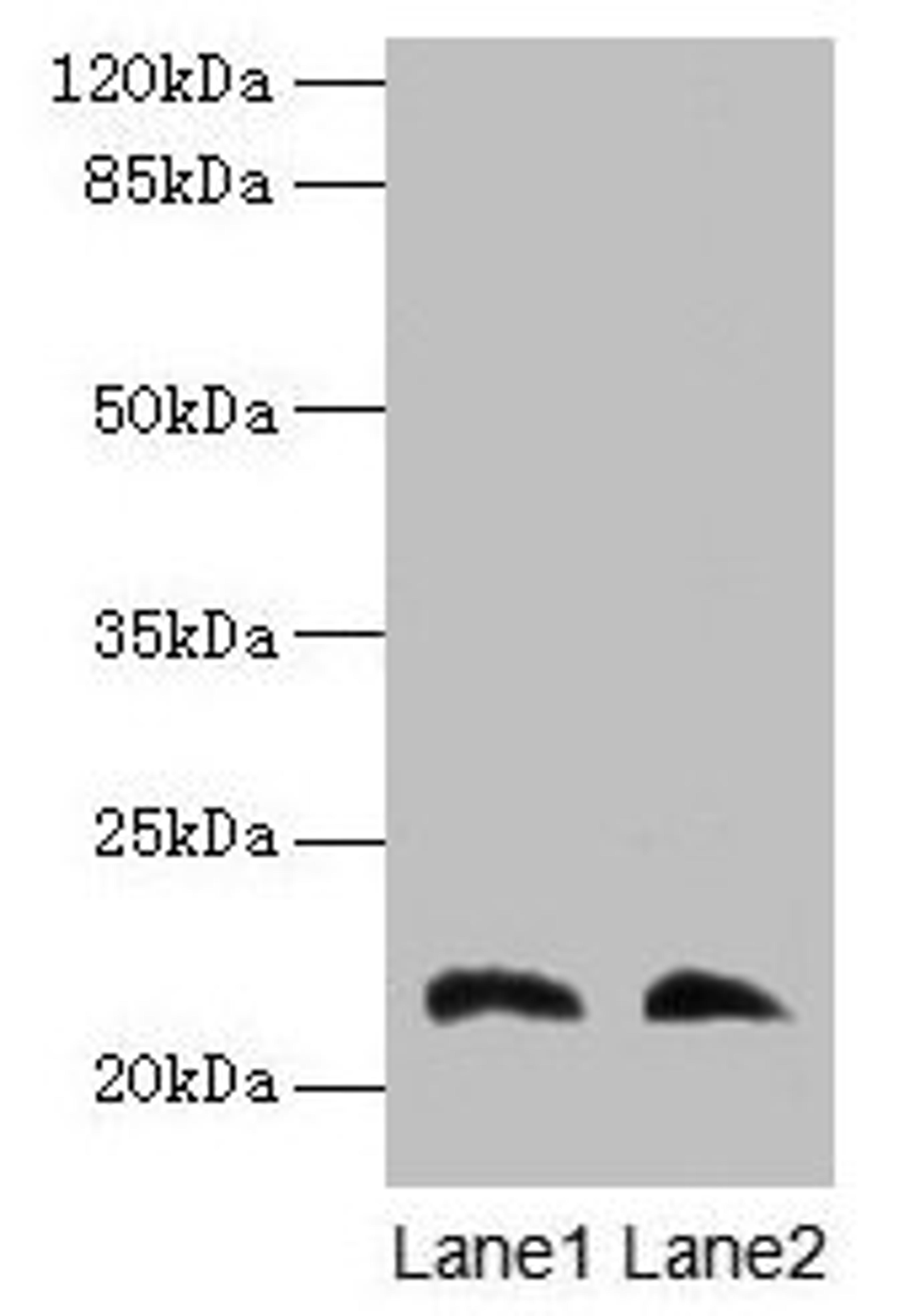 Western blot. All lanes: LGALS9C antibody at 4µg/ml. Lane 1: Mouse stomach tissue. Lane 2: Mouse liver tissue. Secondary. Goat polyclonal to rabbit IgG at 1/10000 dilution. Predicted band size: 40 kDa. Observed band size: 22 kDa