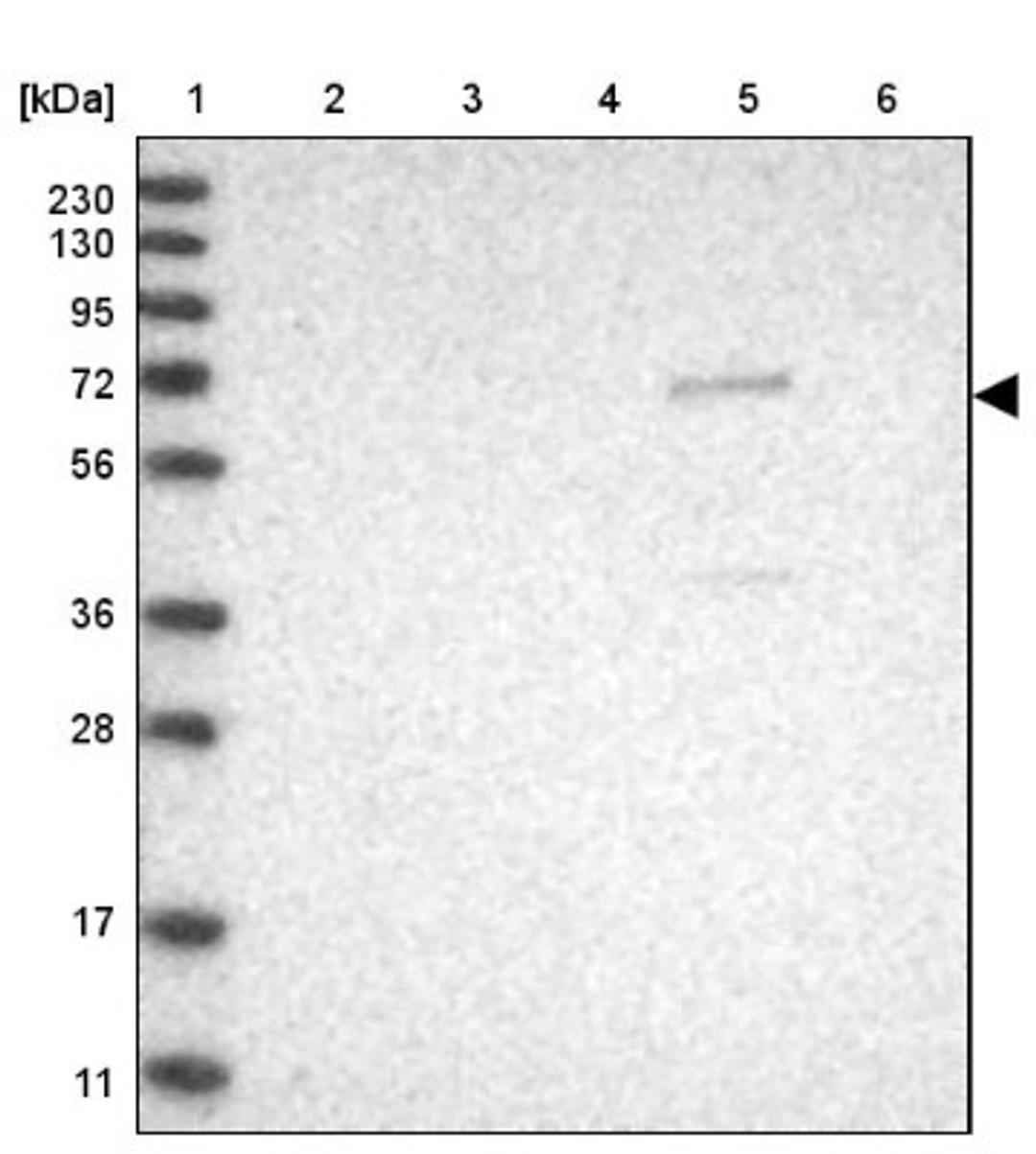 Western Blot: REPS2 Antibody [NBP1-80891] - Lane 1: Marker [kDa] 230, 130, 95, 72, 56, 36, 28, 17, 11<br/>Lane 2: Human cell line RT-4<br/>Lane 3: Human cell line U-251MG sp<br/>Lane 4: Human plasma (IgG/HSA depleted)<br/>Lane 5: Human liver tissue<br/>Lane 6: Human tonsil tissue