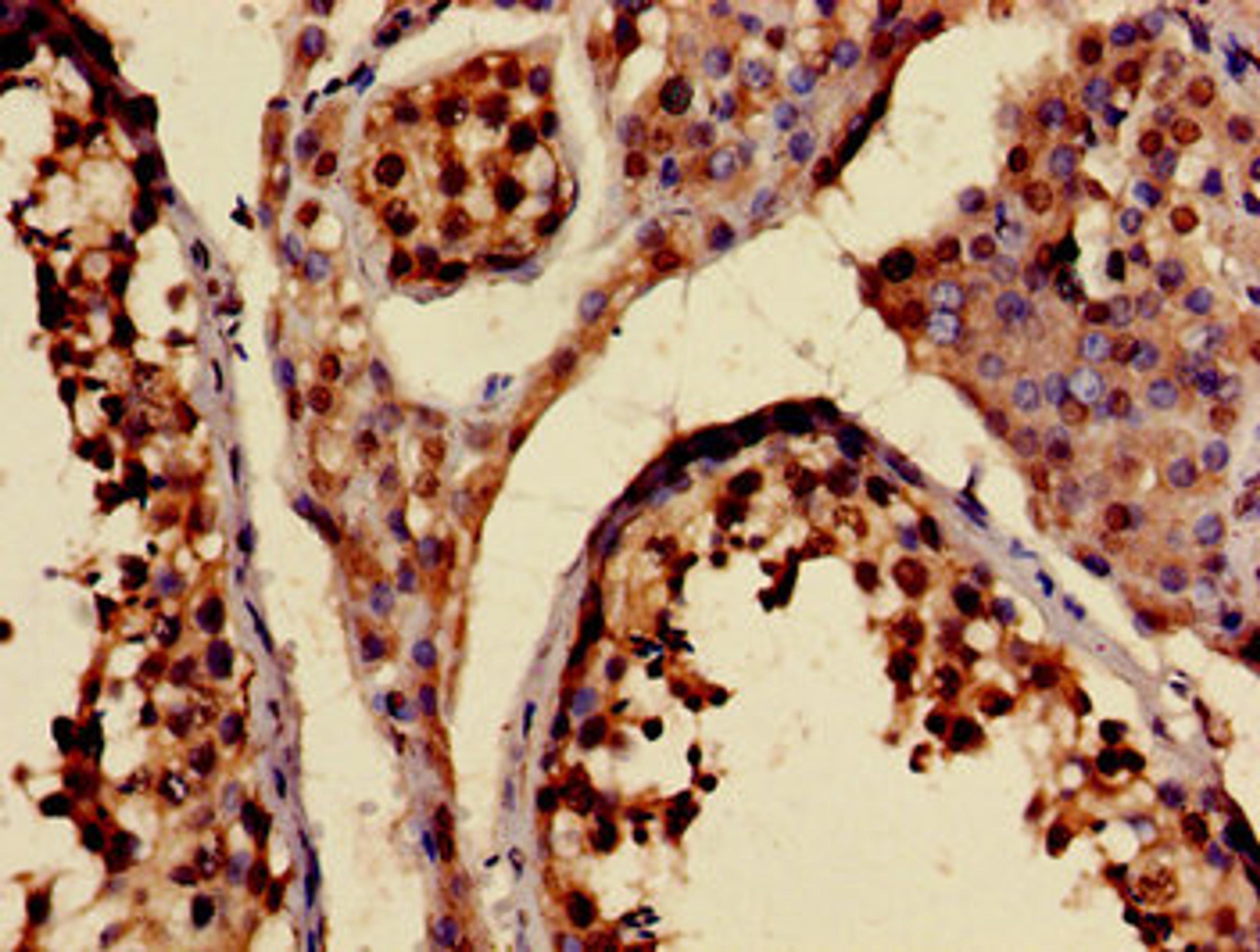 Immunohistochemistry of paraffin-embedded human testis tissue using CSB-PA012321LA01HU at dilution of 1:100