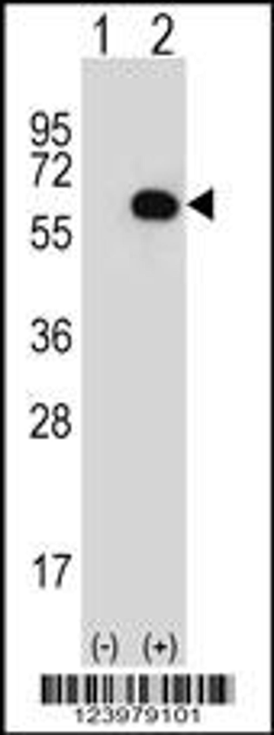 Western blot analysis of GK using rabbit polyclonal GK Antibody using 293 cell lysates (2 ug/lane) either nontransfected (Lane 1) or transiently transfected (Lane 2) with the GK gene.