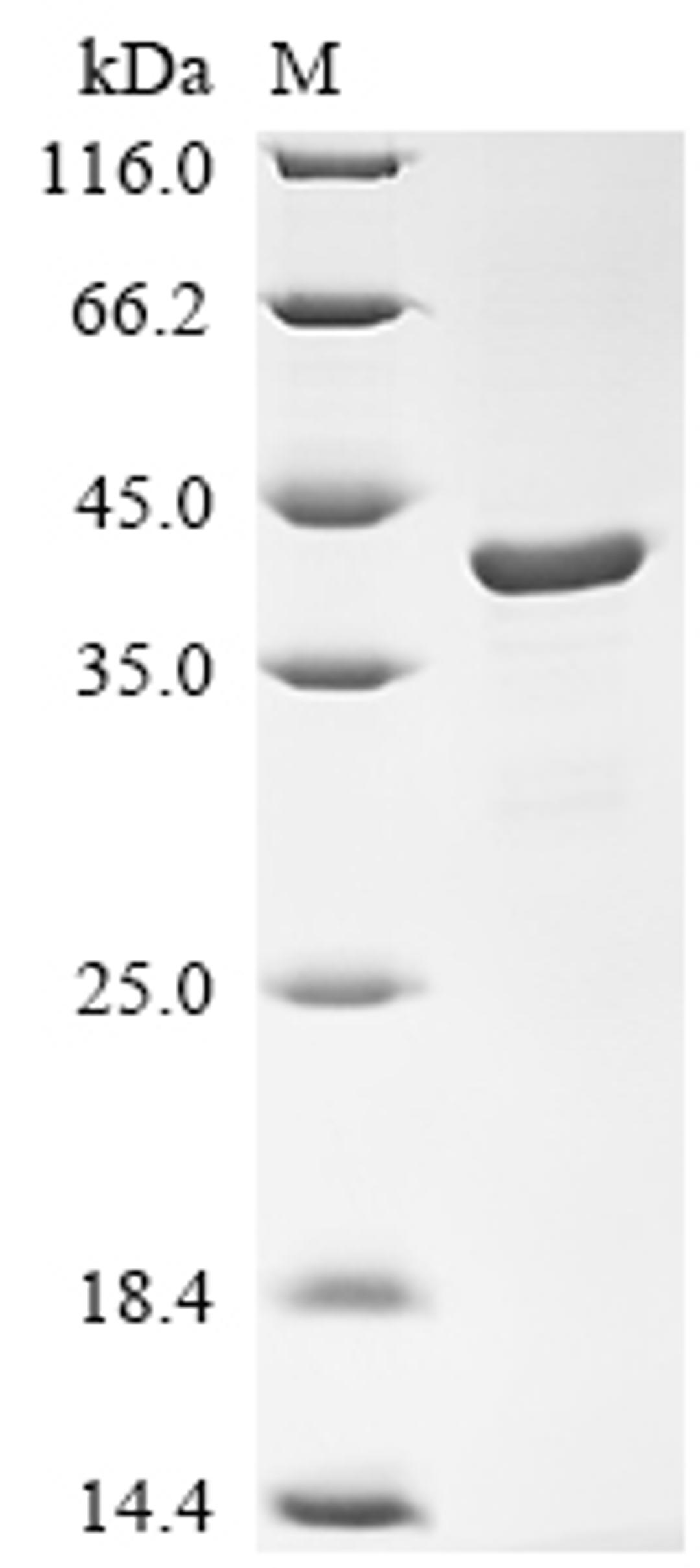 (Tris-Glycine gel) Discontinuous SDS-PAGE (reduced) with 5% enrichment gel and 15% separation gel.