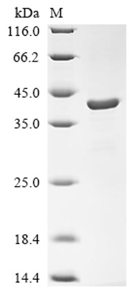 (Tris-Glycine gel) Discontinuous SDS-PAGE (reduced) with 5% enrichment gel and 15% separation gel.