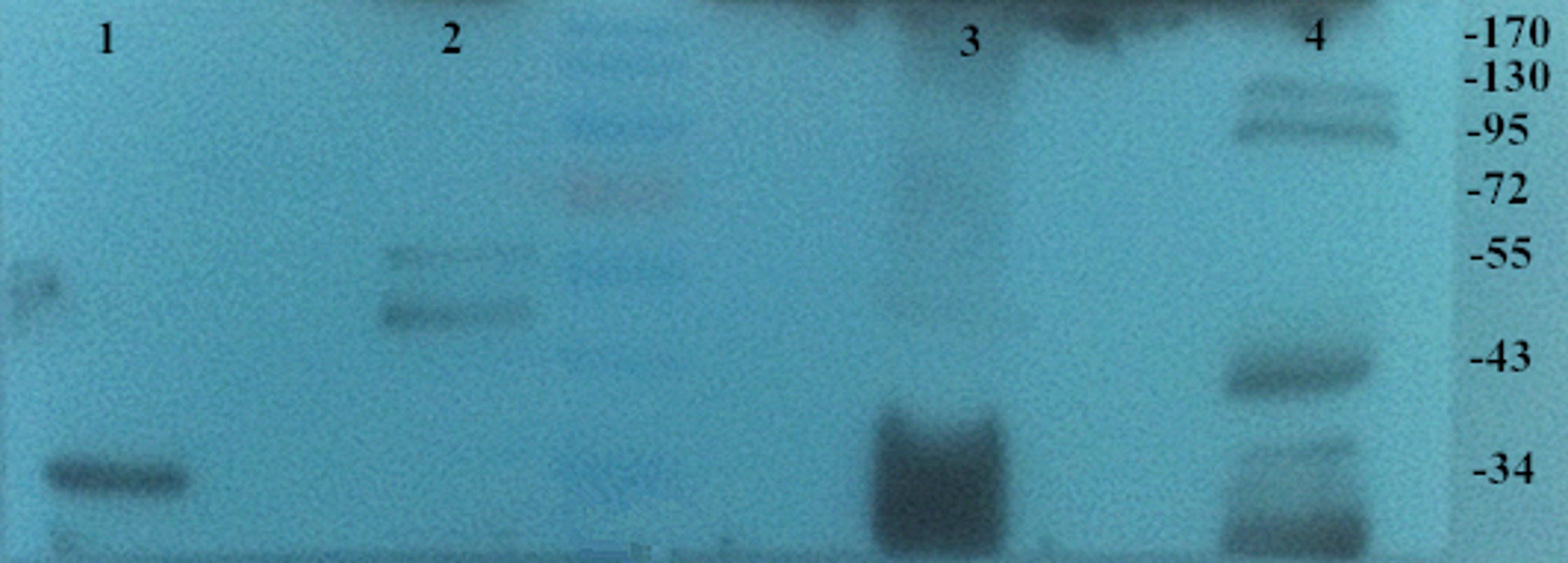 Western blot analysis of Mouse kidney (Lane 1), Mouse heart (Lane 2), Rat kidney (Lane 3), Rat heart (Lane 4) using PGC1 alpha antibody (primary antibody dilution at 2 ug/ml)