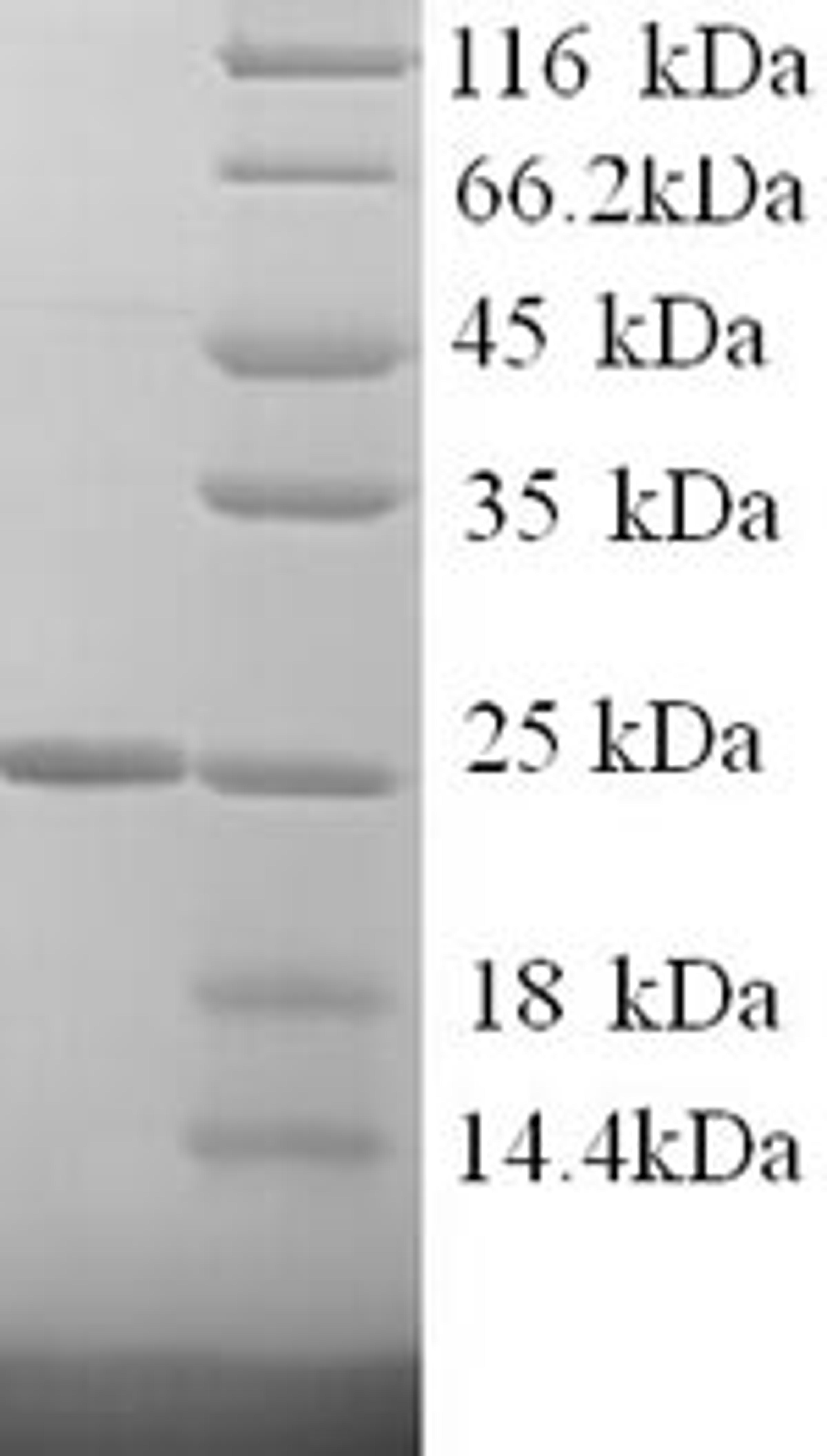 (Tris-Glycine gel) Discontinuous SDS-PAGE (reduced) with 5% enrichment gel and 15% separation gel.