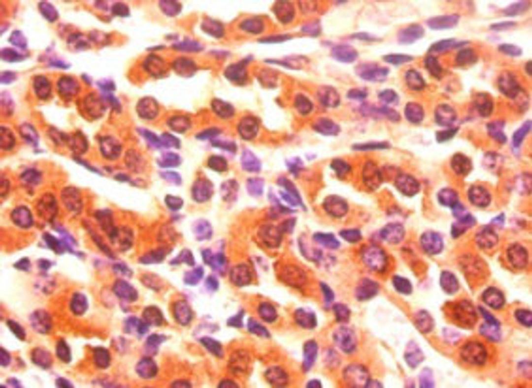 Immunohistochemistry of paraffin-embedded mouse kidney tissue using CSB-PA07764A0Rb at dilution of 1:50