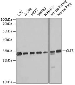 Western blot - CLTB antibody (A8404)