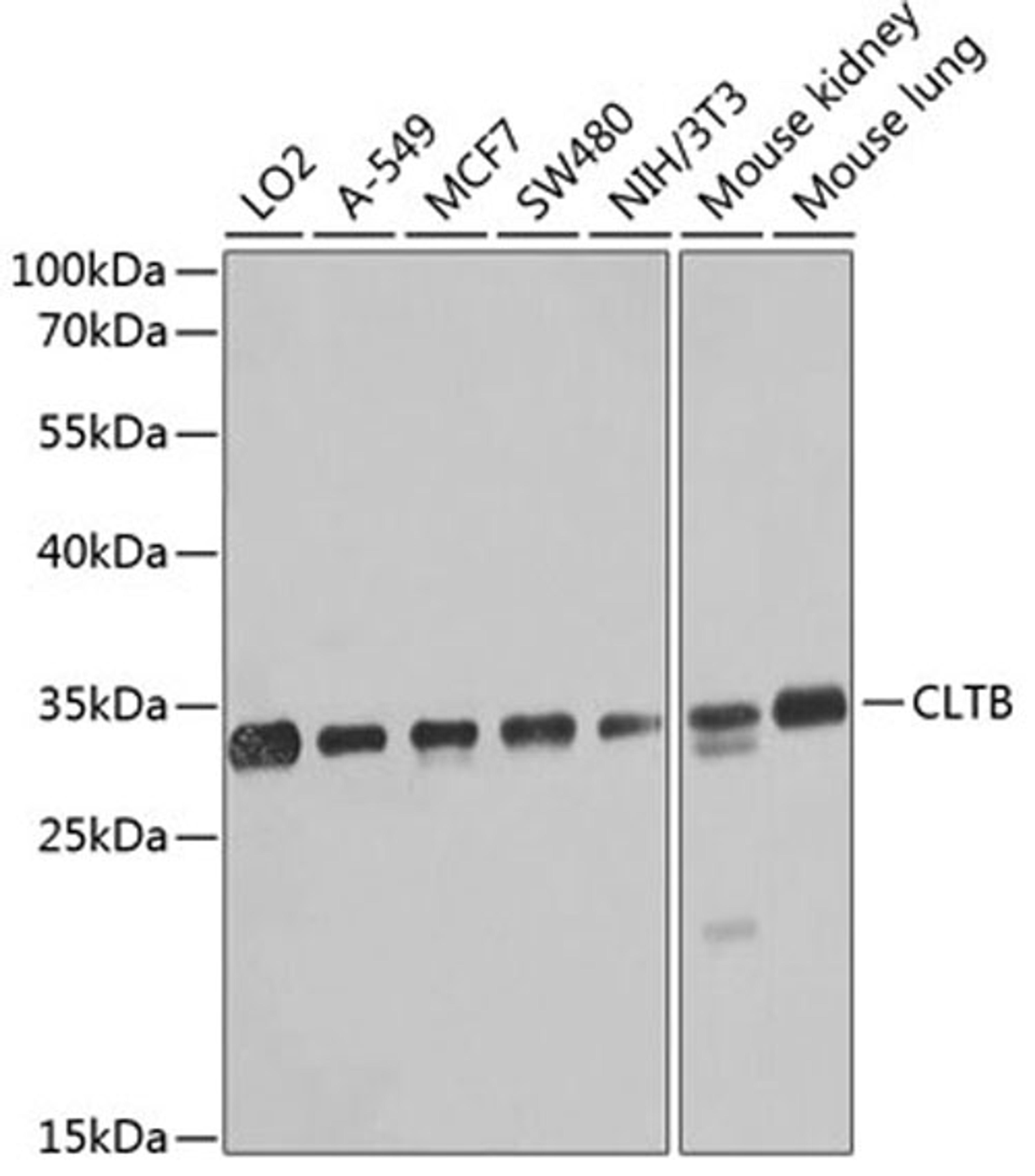 Western blot - CLTB antibody (A8404)