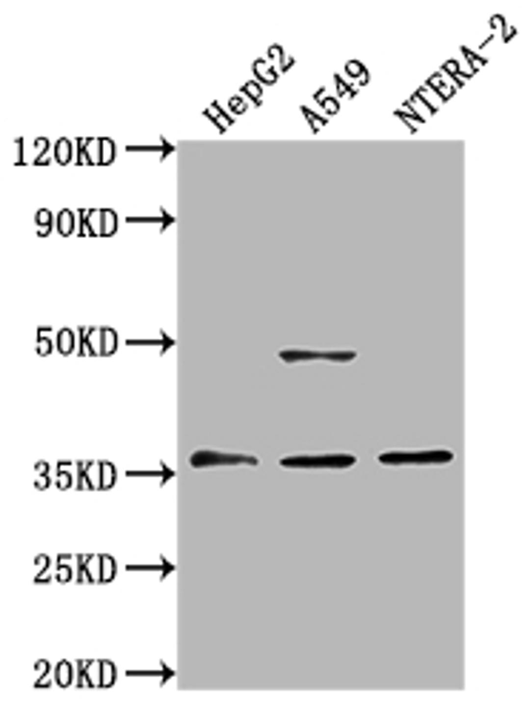 Western Blot. Positive WB detected in: HepG2 whole cell lysate, A549 whole cell lysate, NTERA-2 whole cell lysate. All lanes: OR4D10 antibody at 1:2000. Secondary. Goat polyclonal to rabbit IgG at 1/50000 dilution. Predicted band size: 36 kDa. Observed band size: 36 kDa. 