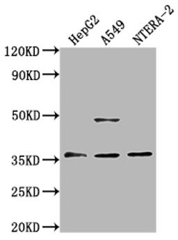 Western Blot. Positive WB detected in: HepG2 whole cell lysate, A549 whole cell lysate, NTERA-2 whole cell lysate. All lanes: OR4D10 antibody at 1:2000. Secondary. Goat polyclonal to rabbit IgG at 1/50000 dilution. Predicted band size: 36 kDa. Observed band size: 36 kDa. 