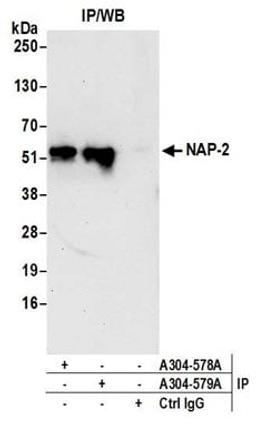 Detection of human NAP-2 by western blot of immunoprecipitates.