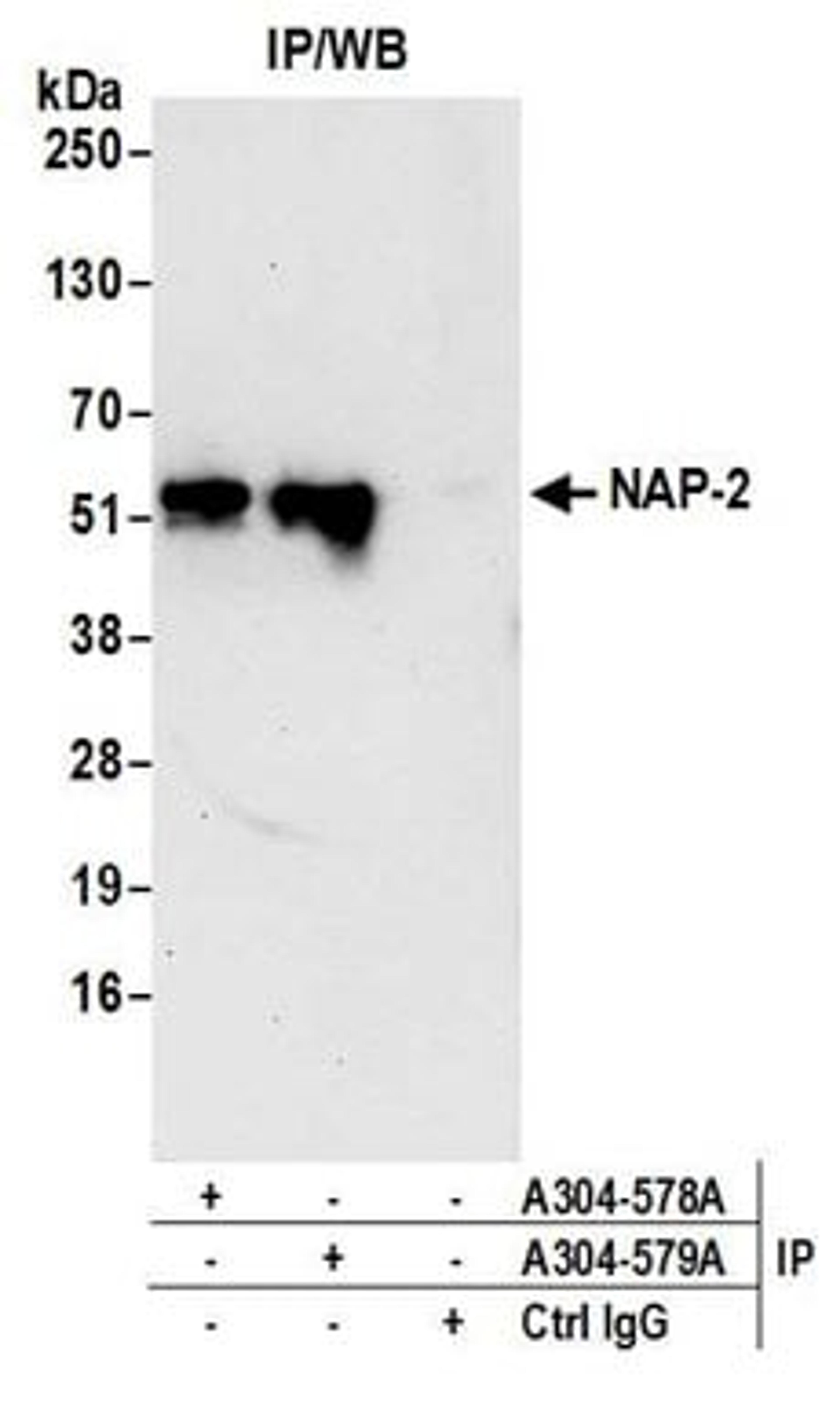 Detection of human NAP-2 by western blot of immunoprecipitates.