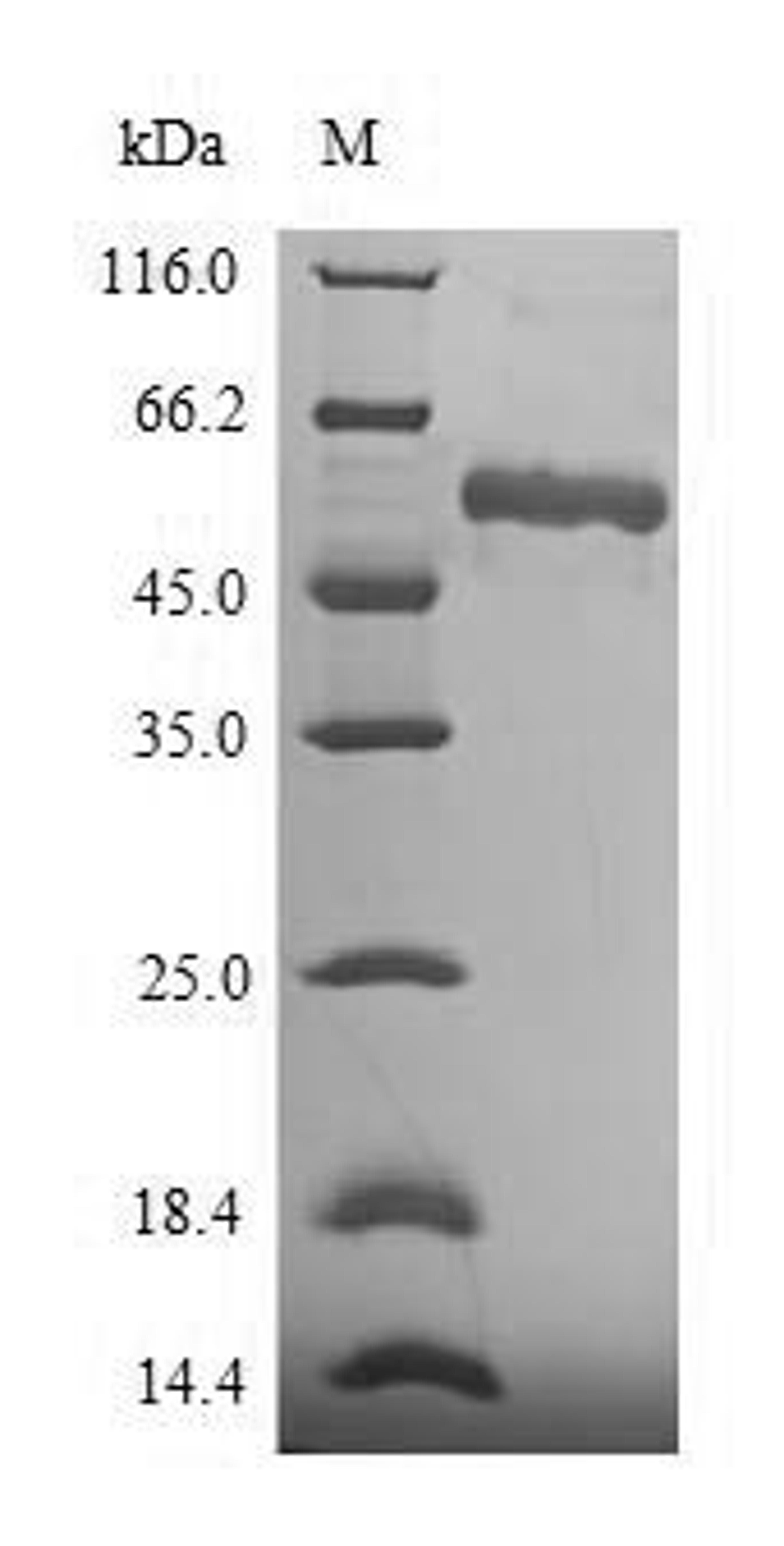 (Tris-Glycine gel) Discontinuous SDS-PAGE (reduced) with 5% enrichment gel and 15% separation gel.