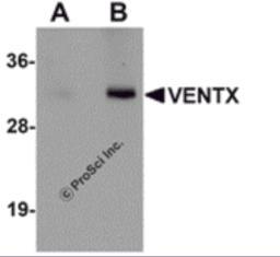 Western blot analysis of VENTX in mouse brain tissue lysate with VENTX antibody at (A) 1 and (B) 2 &#956;g/mL.