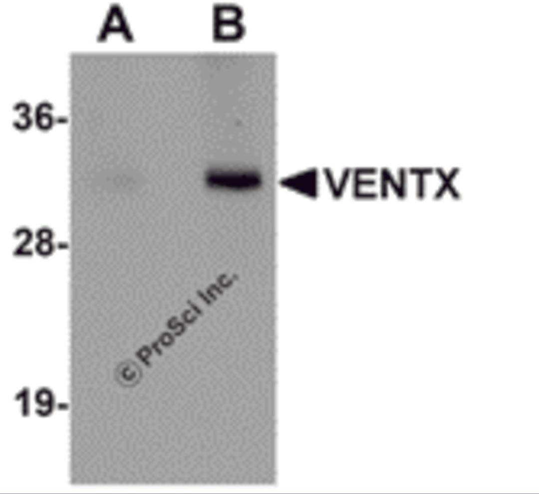 Western blot analysis of VENTX in mouse brain tissue lysate with VENTX antibody at (A) 1 and (B) 2 μg/mL.