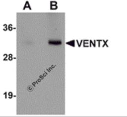 Western blot analysis of VENTX in mouse brain tissue lysate with VENTX antibody at (A) 1 and (B) 2 μg/mL.