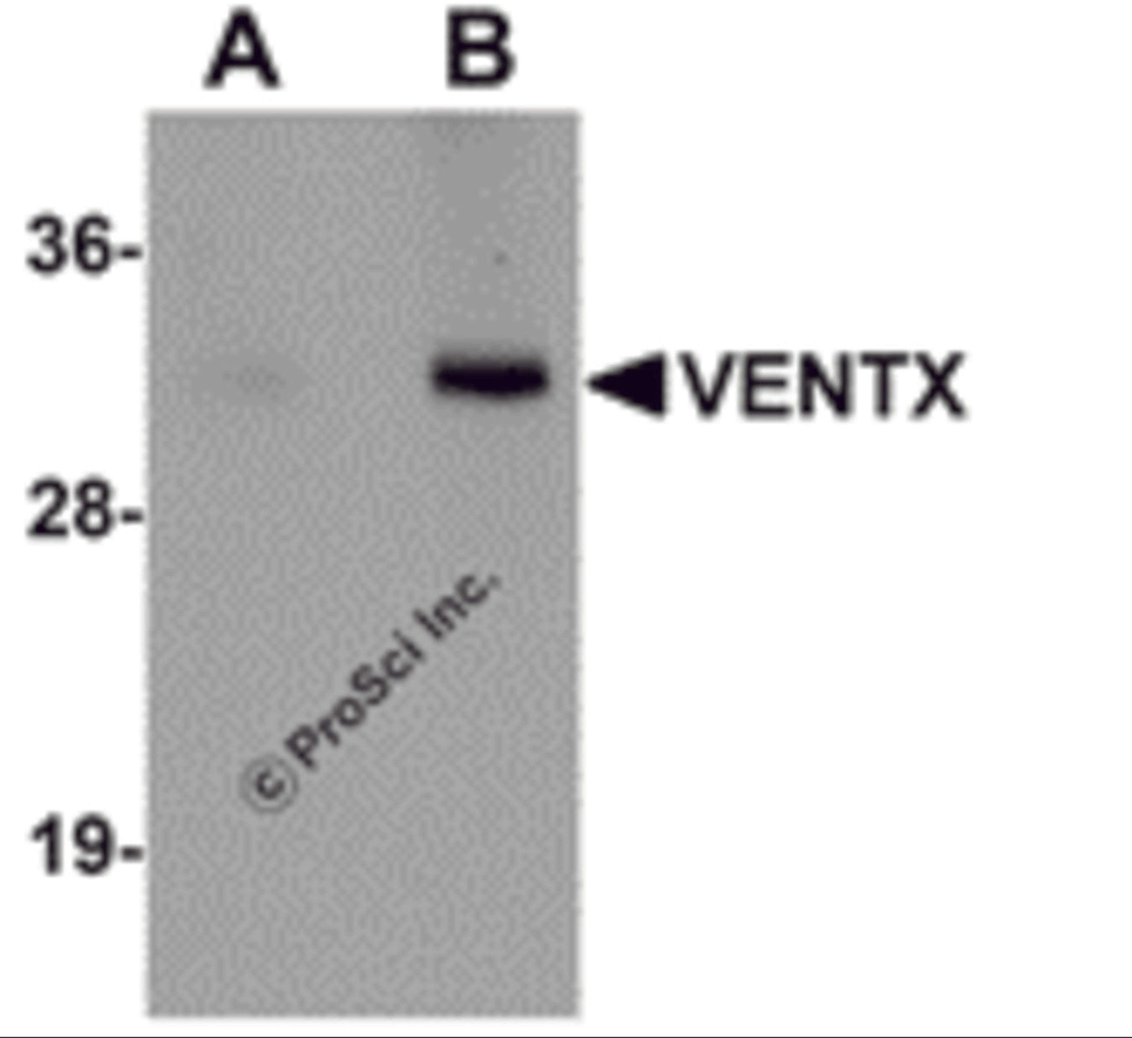 Western blot analysis of VENTX in mouse brain tissue lysate with VENTX antibody at (A) 1 and (B) 2 μg/mL.