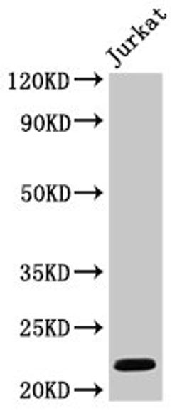 Western Blot. Positive WB detected in: Jurkat whole cell lysate. All lanes: HIST1H1C antibody at 1µg/ml. Secondary. Goat polyclonal to rabbit IgG at 1/50000 dilution. Predicted band size: 22 kDa. Observed band size: 22 kDa