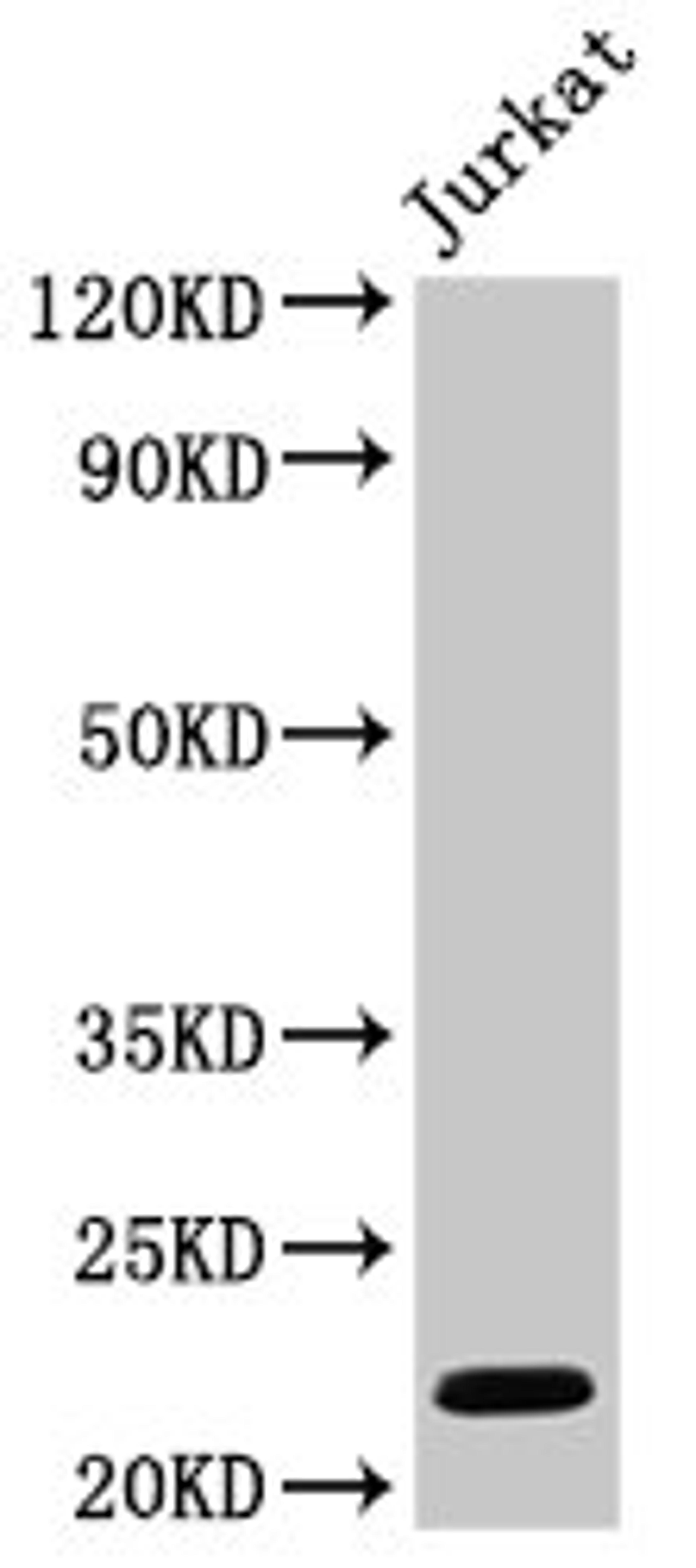 Western Blot. Positive WB detected in: Jurkat whole cell lysate. All lanes: HIST1H1C antibody at 1µg/ml. Secondary. Goat polyclonal to rabbit IgG at 1/50000 dilution. Predicted band size: 22 kDa. Observed band size: 22 kDa