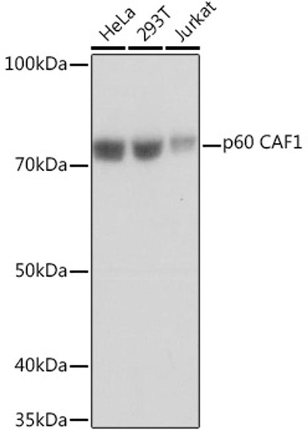 Western blot - p60 CAF1 Rabbit mAb (A5073)