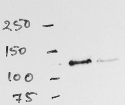 Western Blot: RNF20 Antibody [NB100-2242] - WB analysis of RNF20 in HeLa whole cell lysate. Image courtesy of anonymous customer product review.