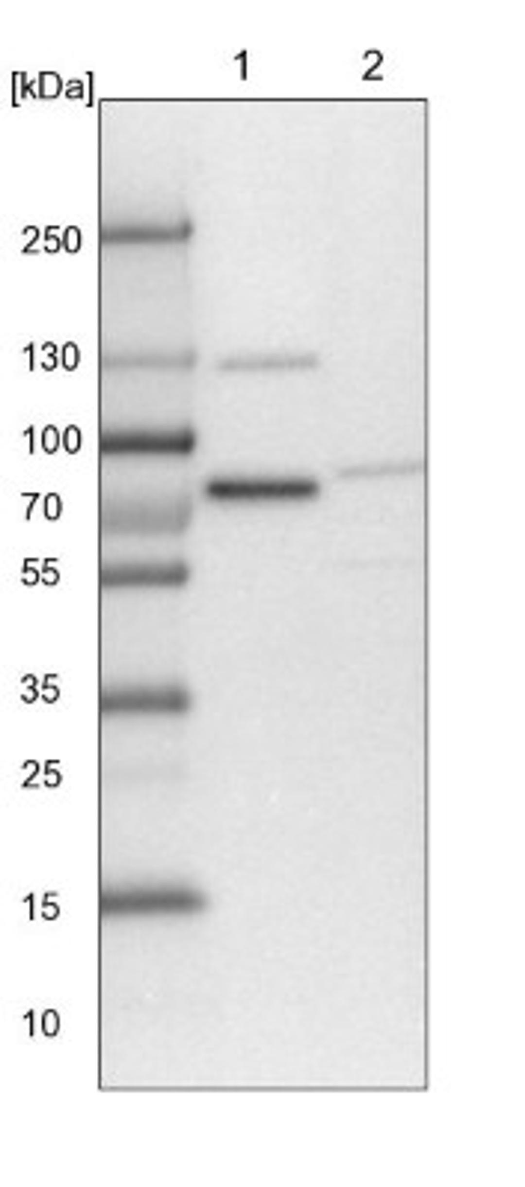 Western Blot: TMTC2 Antibody [NBP1-85027] - Lane 1: NIH-3T3 cell lysate (Mouse embryonic fibroblast cells)<br/>Lane 2: NBT-II cell lysate (Rat Wistar bladder tumour cells)