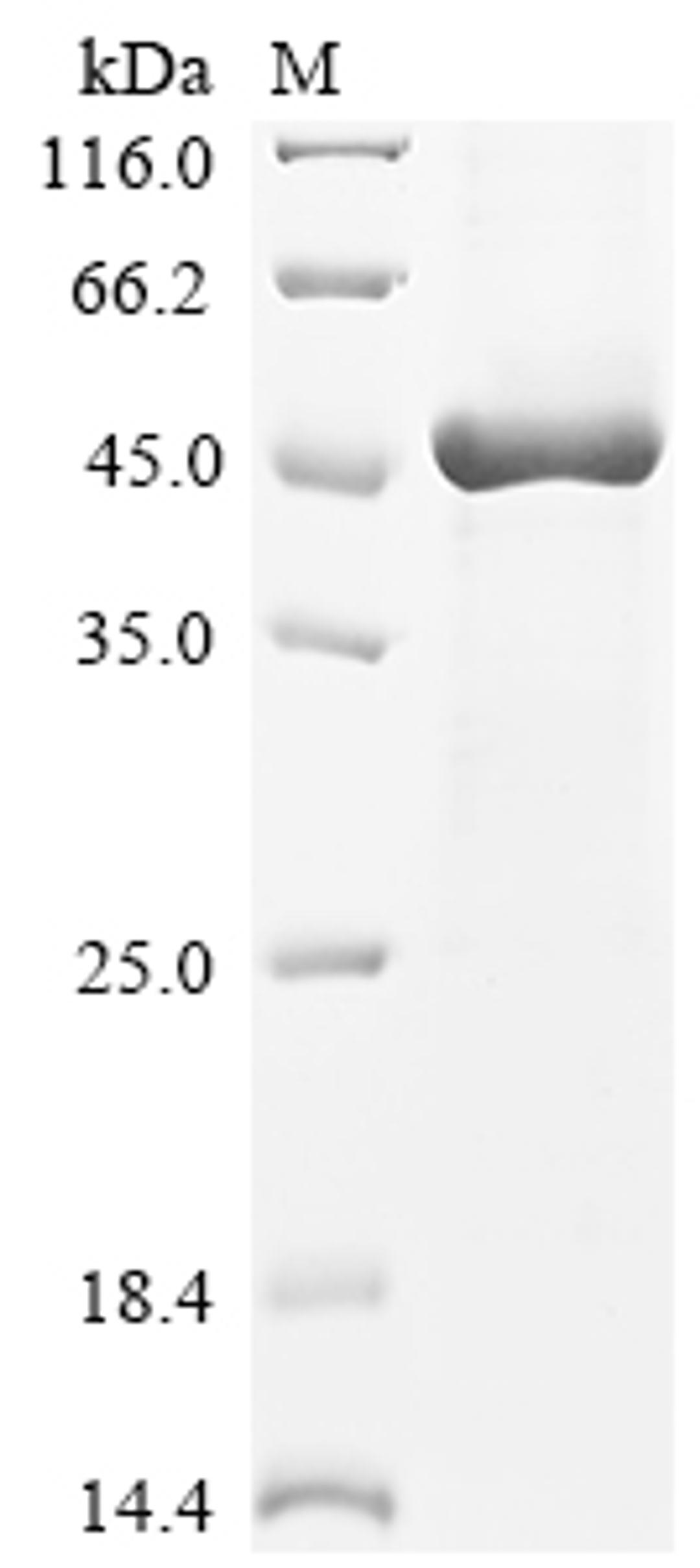 (Tris-Glycine gel) Discontinuous SDS-PAGE (reduced) with 5% enrichment gel and 15% separation gel.