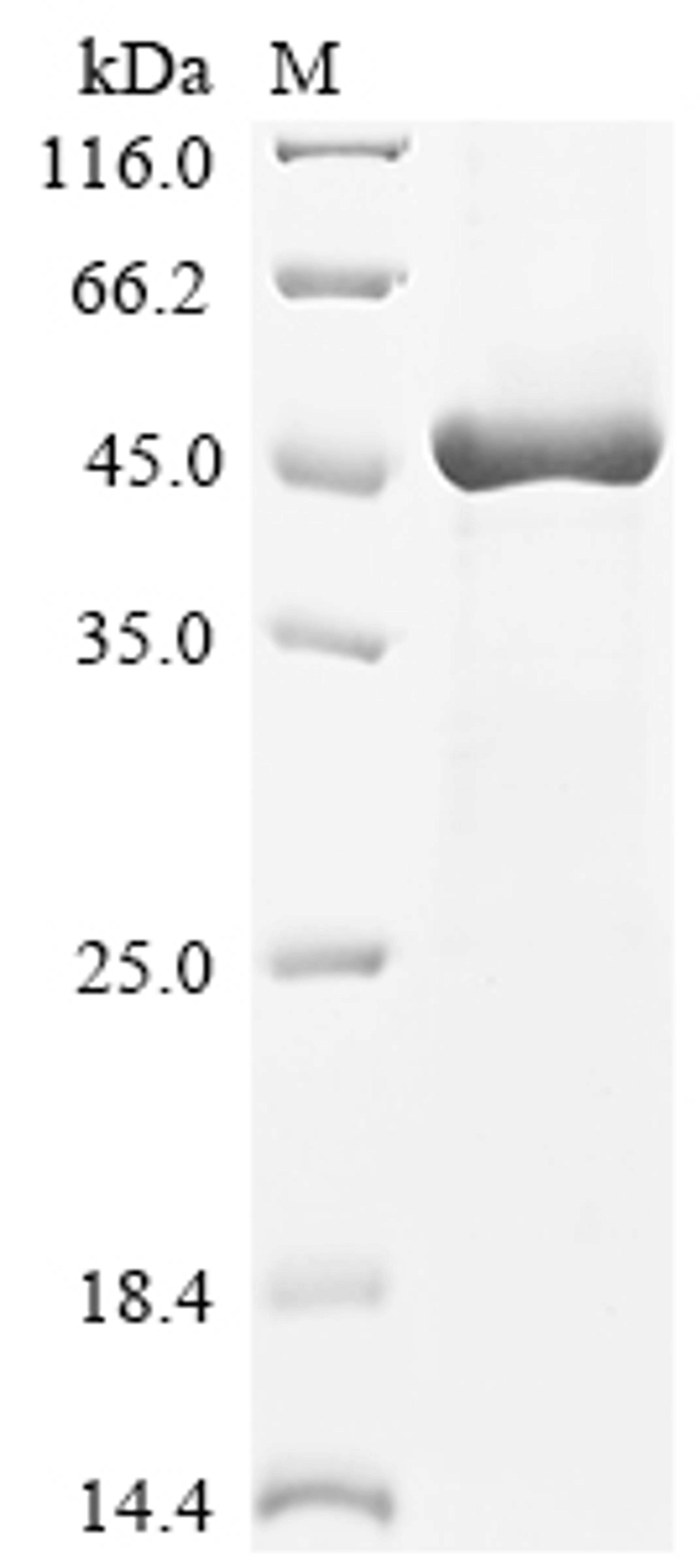 (Tris-Glycine gel) Discontinuous SDS-PAGE (reduced) with 5% enrichment gel and 15% separation gel.