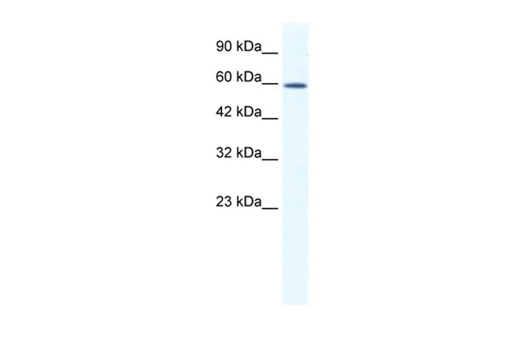 Antibody used in WB on Human Jurkat 1.25 ug/ml.