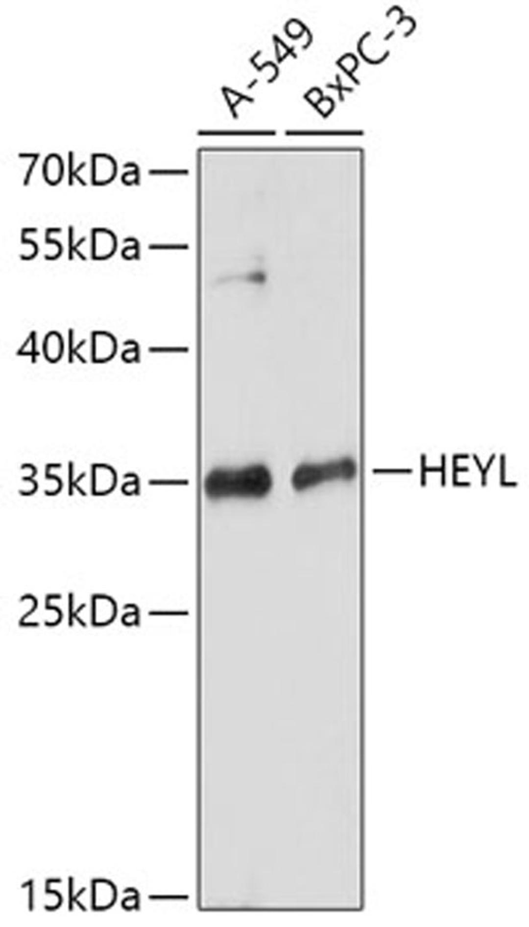 Western blot - HEYL antibody (A17683)