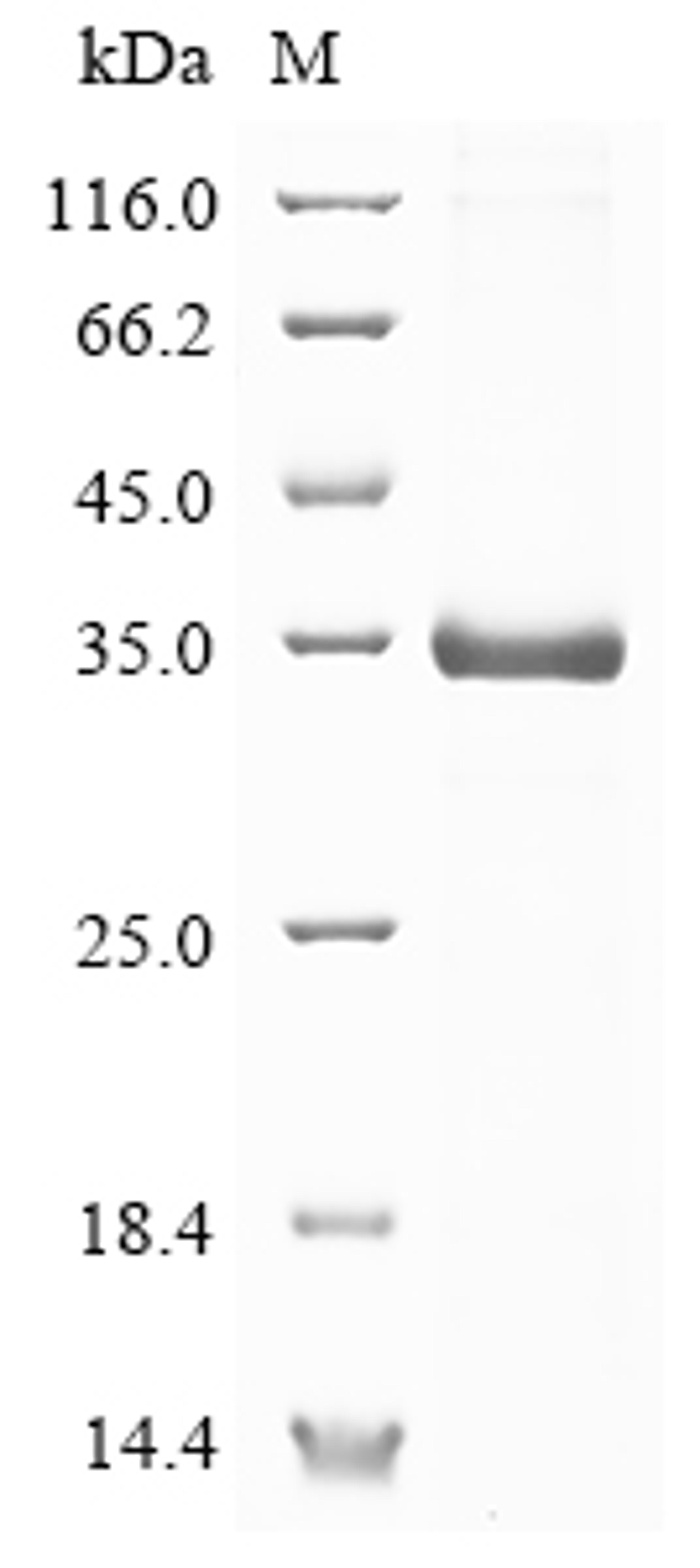 (Tris-Glycine gel) Discontinuous SDS-PAGE (reduced) with 5% enrichment gel and 15% separation gel.