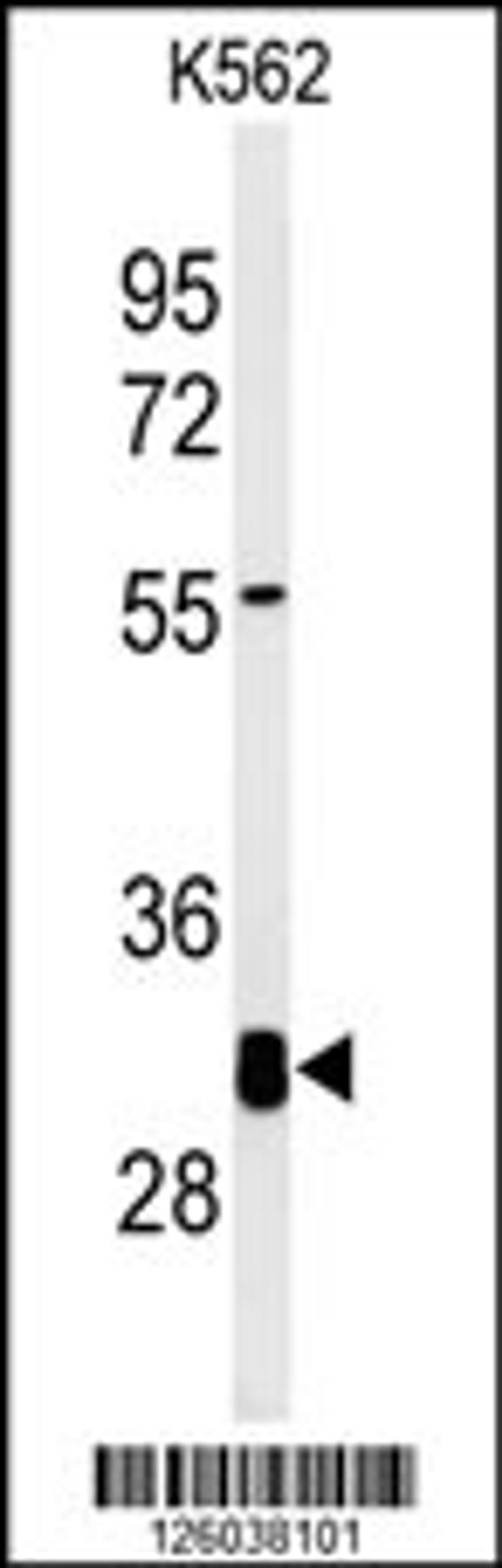 Western blot analysis of KCTD7 Antibody in K562 cell line lysates (35ug/lane)