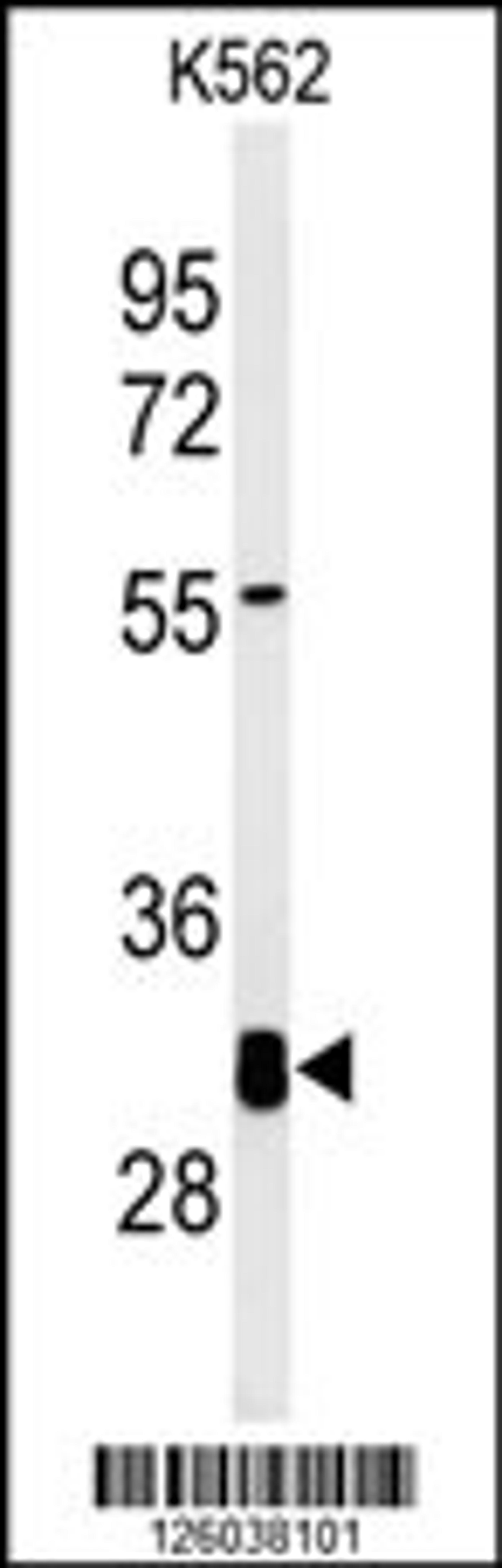 Western blot analysis of KCTD7 Antibody in K562 cell line lysates (35ug/lane)