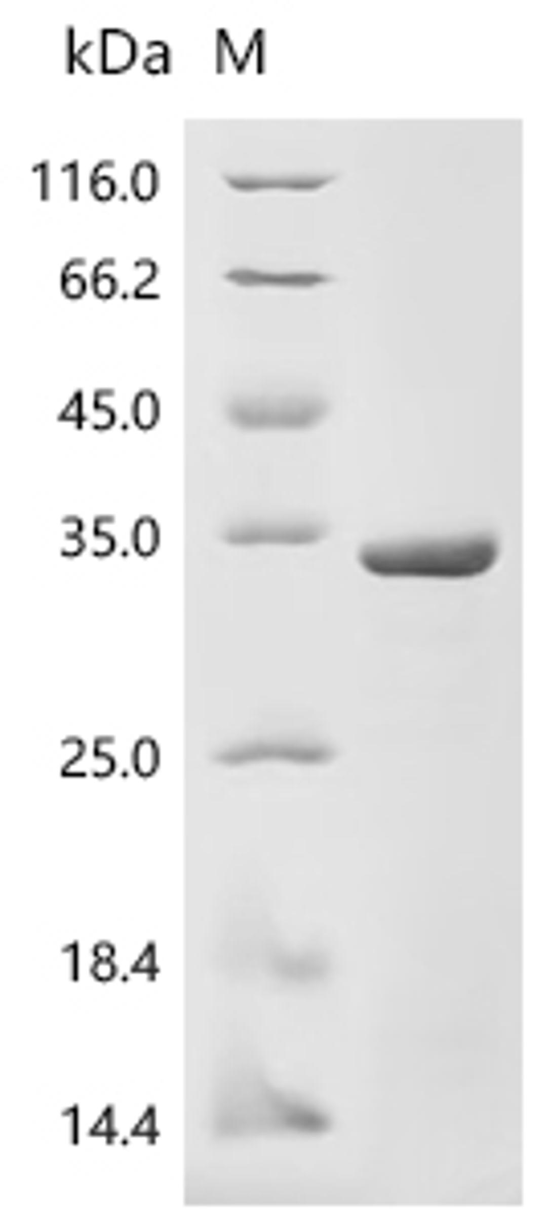 (Tris-Glycine gel) Discontinuous SDS-PAGE (reduced) with 5% enrichment gel and 15% separation gel.