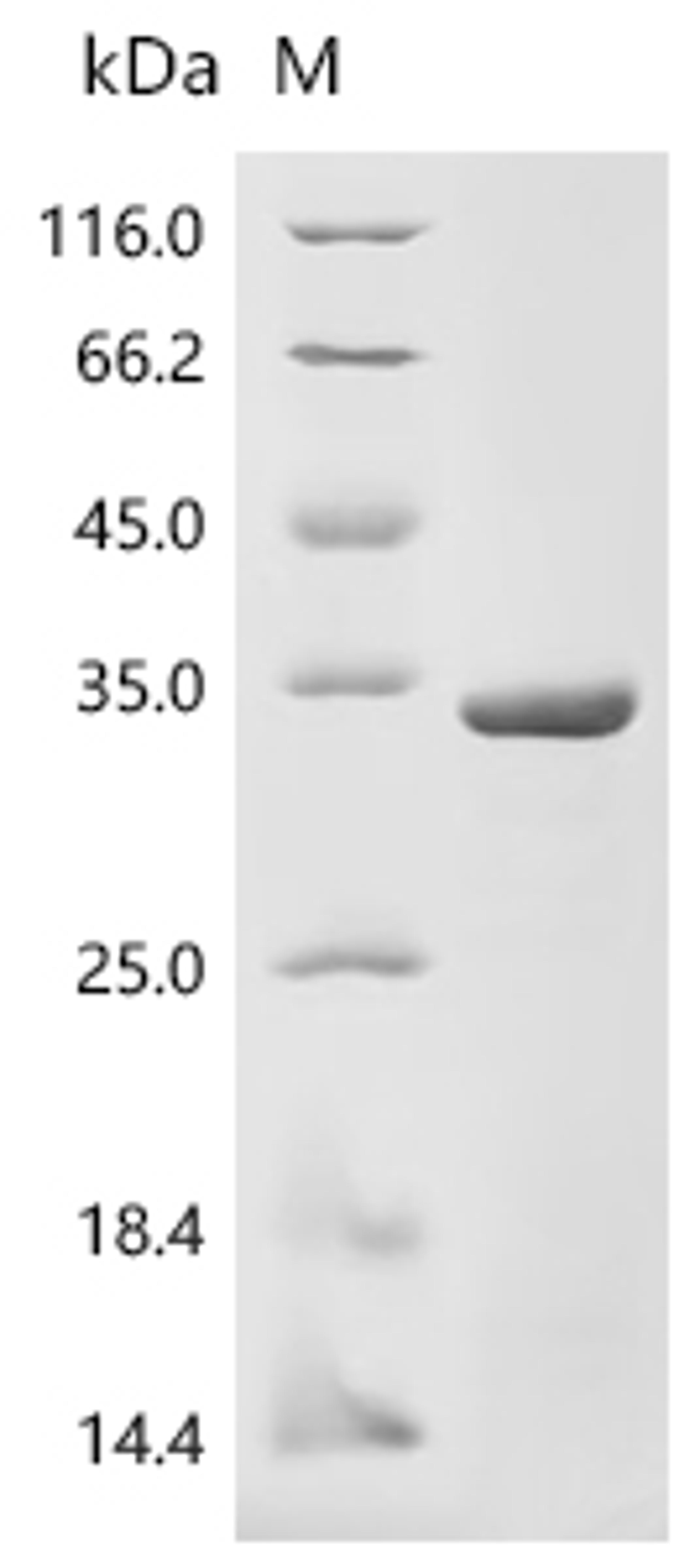 (Tris-Glycine gel) Discontinuous SDS-PAGE (reduced) with 5% enrichment gel and 15% separation gel.