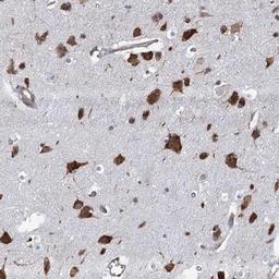 Immunohistochemistry-Paraffin: KCC4/SLC12A7 Antibody [NBP1-85133] - KCC4 Antibody [NBP1-85133] - Staining of human cerebral cortex shows strong cytoplasmic positivity in neuronal cells.