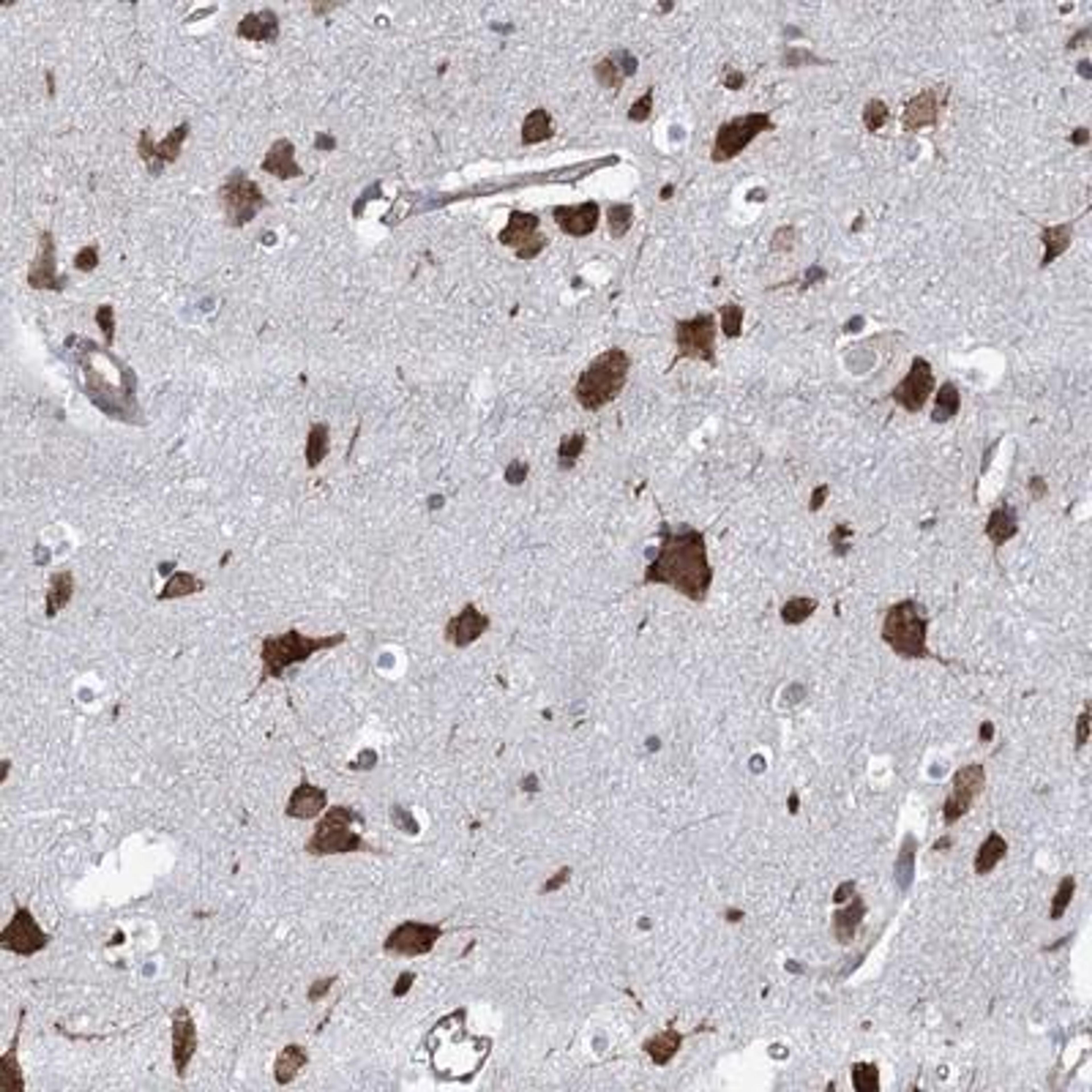 Immunohistochemistry-Paraffin: KCC4/SLC12A7 Antibody [NBP1-85133] - KCC4 Antibody [NBP1-85133] - Staining of human cerebral cortex shows strong cytoplasmic positivity in neuronal cells.