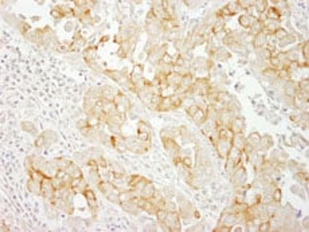 Detection of human Notch2 by immunohistochemistry.