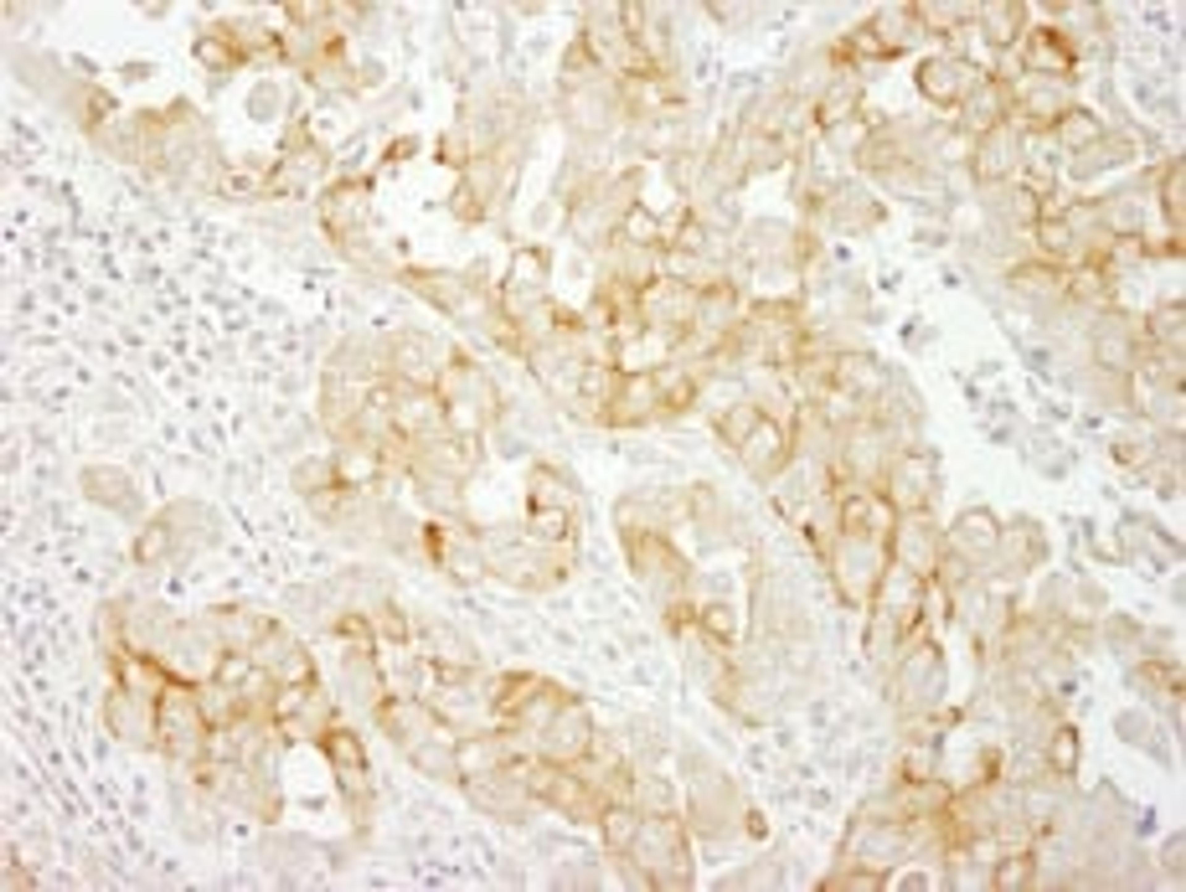 Detection of human Notch2 by immunohistochemistry.