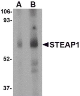 Western blot analysis of STEAP1 in human spleen tissue lysate with STEAP1 antibody at (A) 1 and (B) 2 &#956;g/mL.