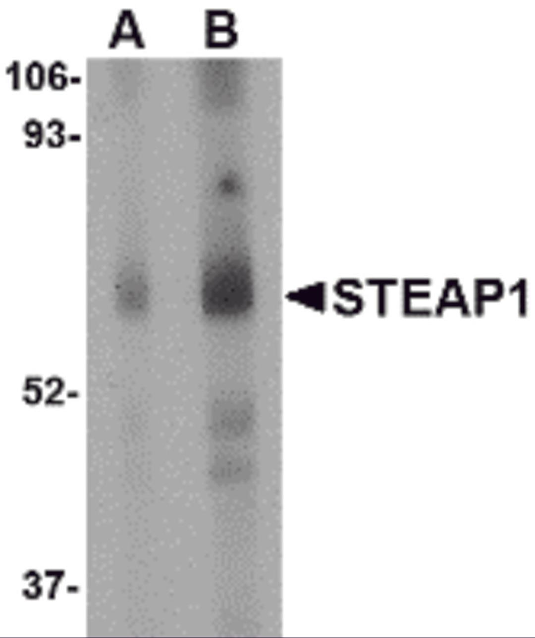 Western blot analysis of STEAP1 in human spleen tissue lysate with STEAP1 antibody at (A) 1 and (B) 2 μg/mL.