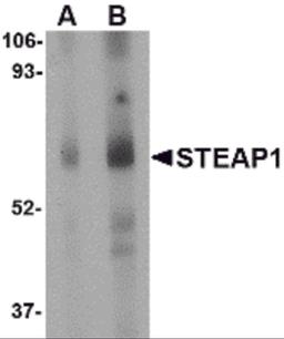 Western blot analysis of STEAP1 in human spleen tissue lysate with STEAP1 antibody at (A) 1 and (B) 2 μg/mL.