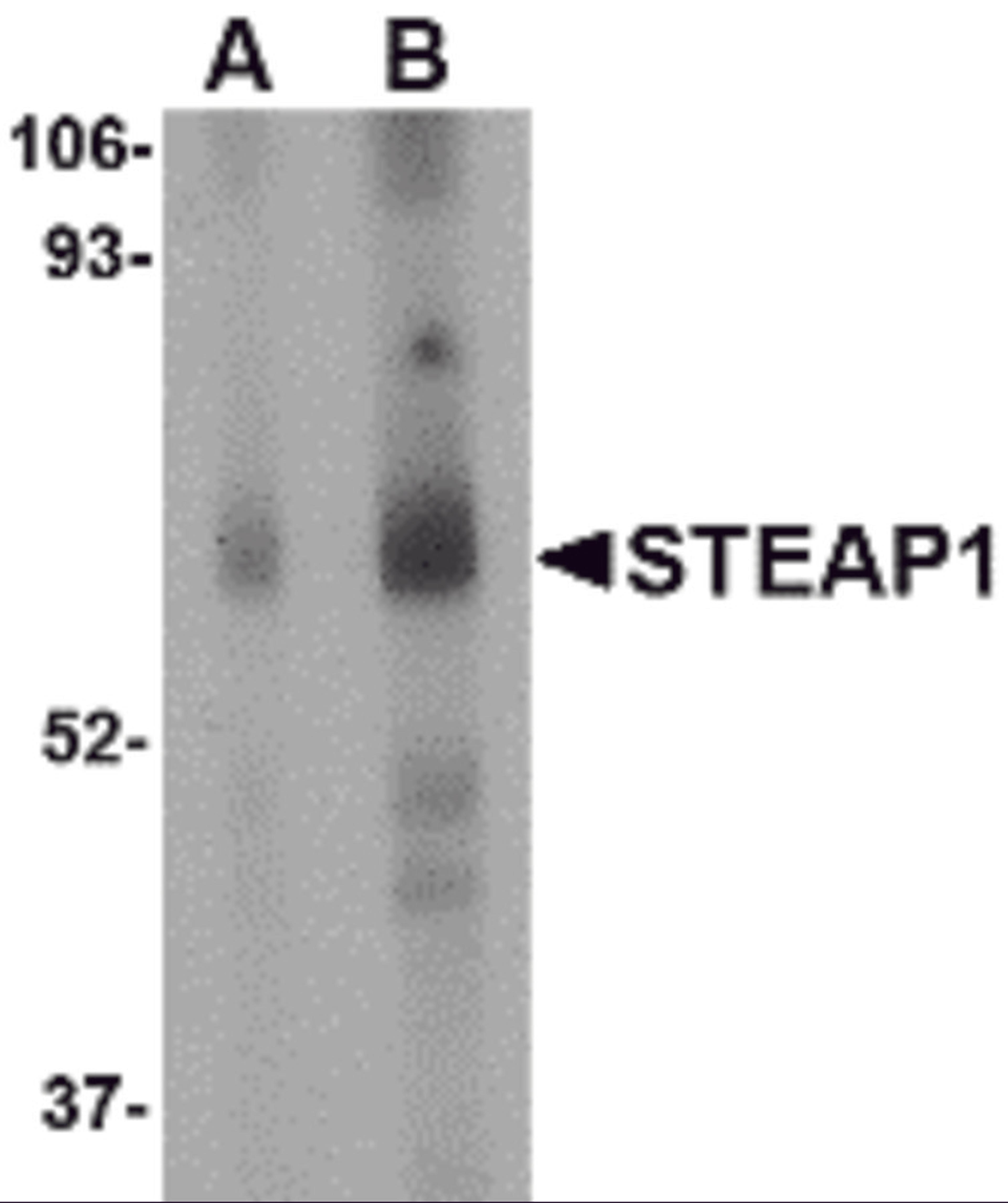 Western blot analysis of STEAP1 in human spleen tissue lysate with STEAP1 antibody at (A) 1 and (B) 2 μg/mL.