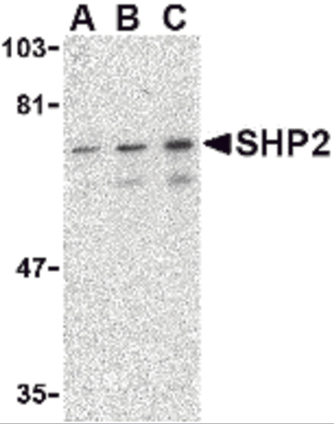 Western blot analysis of SHP2 in mouse skeletal muscle tissue lysate with SHP2 antibody at (A) 0.5, (B) 1 and (C) 2 &#956;g/mL. 