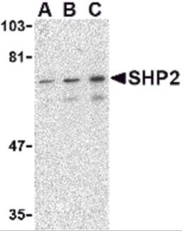 Western blot analysis of SHP2 in mouse skeletal muscle tissue lysate with SHP2 antibody at (A) 0.5, (B) 1 and (C) 2 &#956;g/mL. 