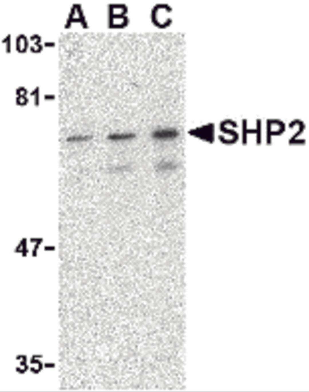 Western blot analysis of SHP2 in mouse skeletal muscle tissue lysate with SHP2 antibody at (A) 0.5, (B) 1 and (C) 2 μg/mL.