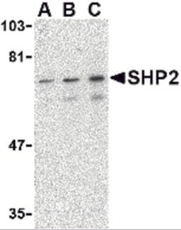 Western blot analysis of SHP2 in mouse skeletal muscle tissue lysate with SHP2 antibody at (A) 0.5, (B) 1 and (C) 2 μg/mL.
