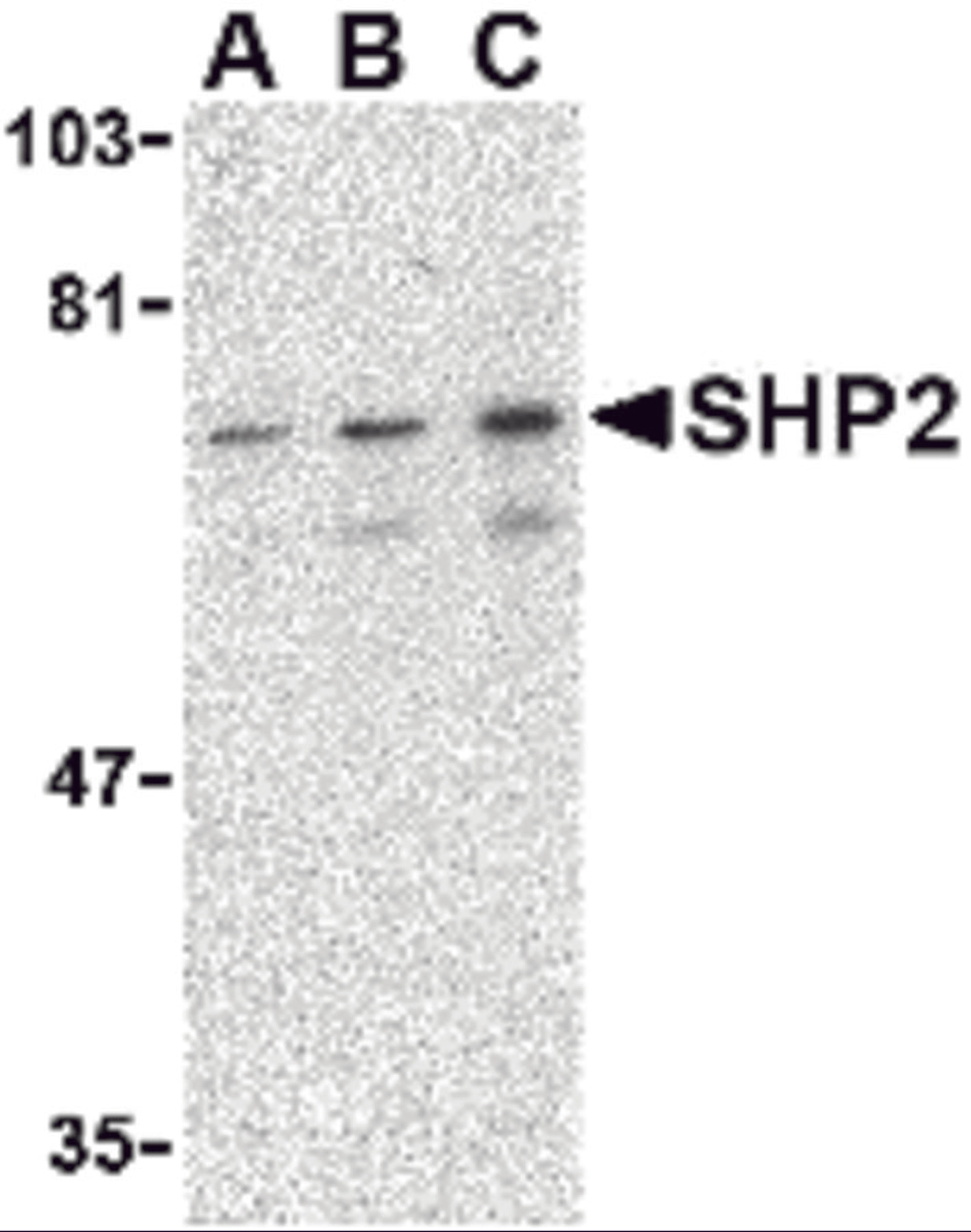Western blot analysis of SHP2 in mouse skeletal muscle tissue lysate with SHP2 antibody at (A) 0.5, (B) 1 and (C) 2 μg/mL.