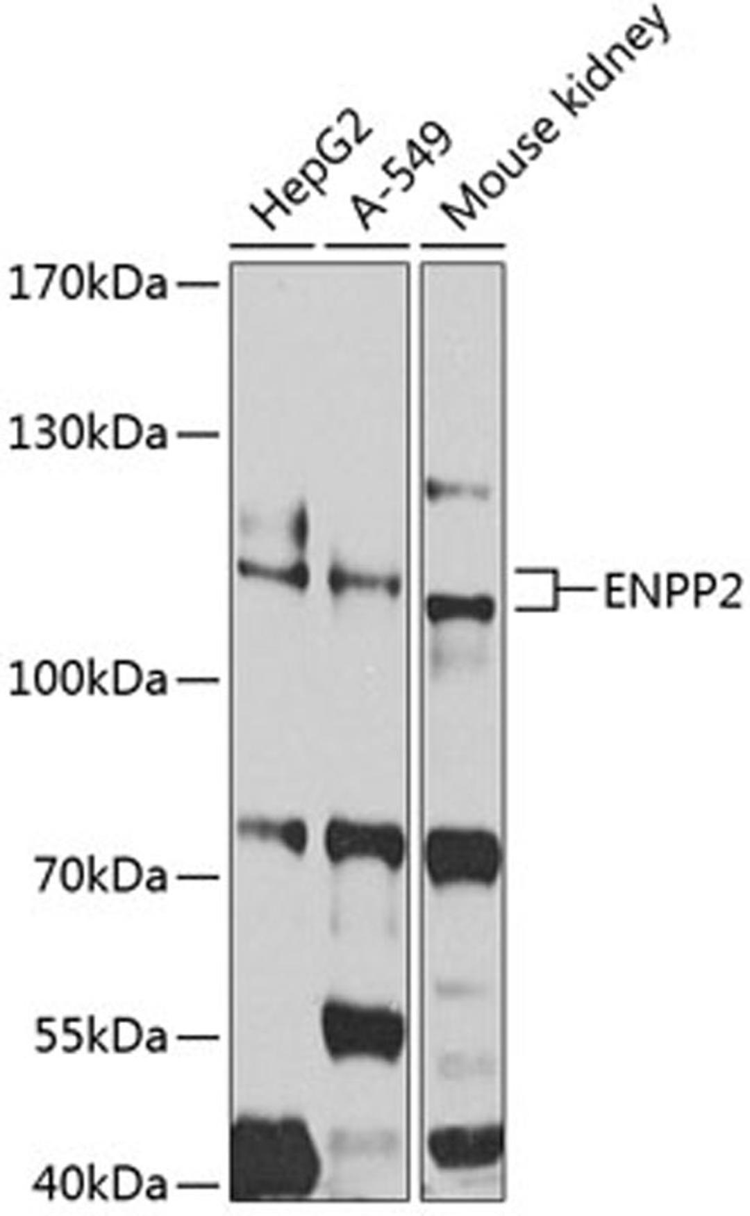 Western blot - ENPP2 antibody (A2522)